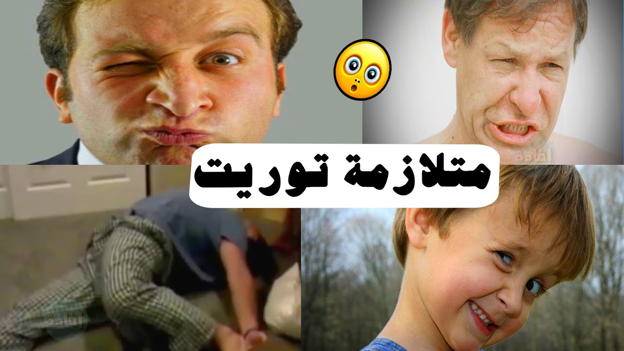 ما هي متلازمة توريت وما هي أسبابها وأعراضها وعلاجها؟